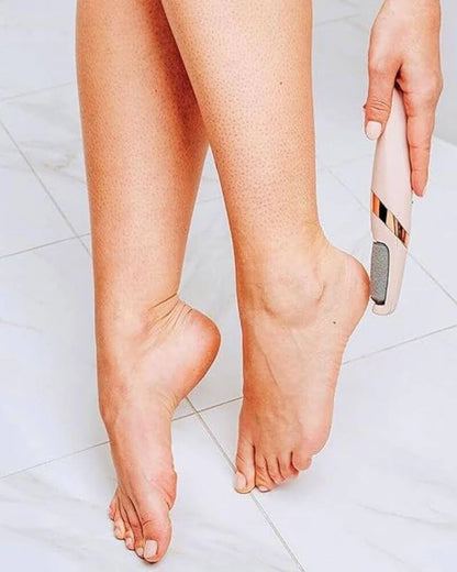 Removedor de Callos Klynea